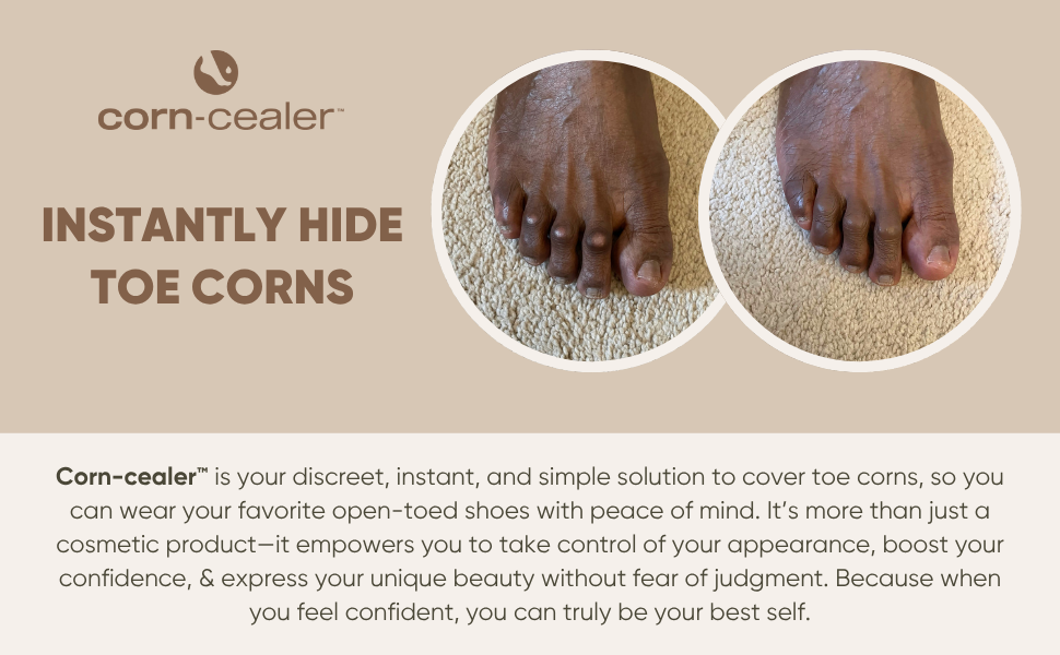 Instantly hide embarrassing toe cornsInstantly hide embarrassing toe corns