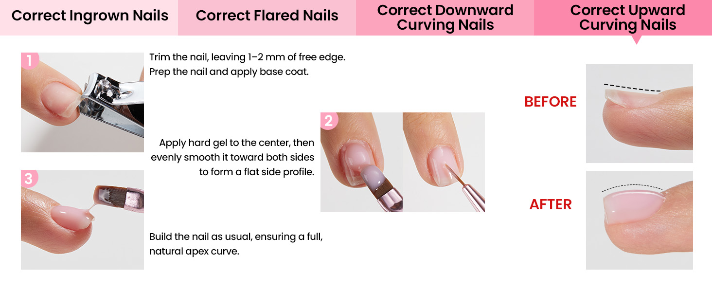 Correct upward curving nails