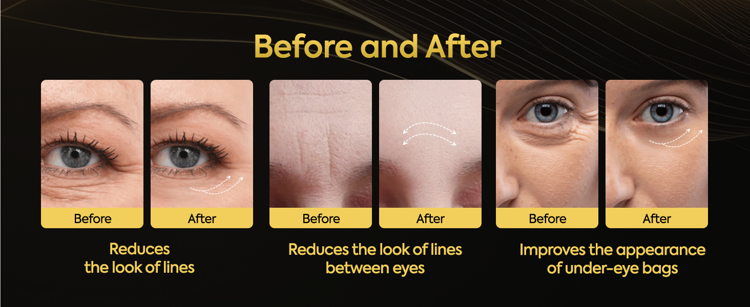 Temporary Eye Tightener