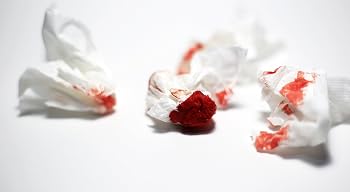 Nosebleed Issue