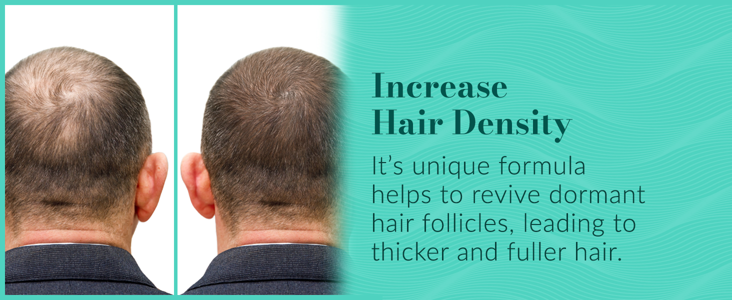 best hair growth serum with redensyl biotin vitamin e for scalp strengthening natural hair serum