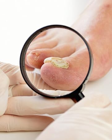 thick toenail clippers for seniors