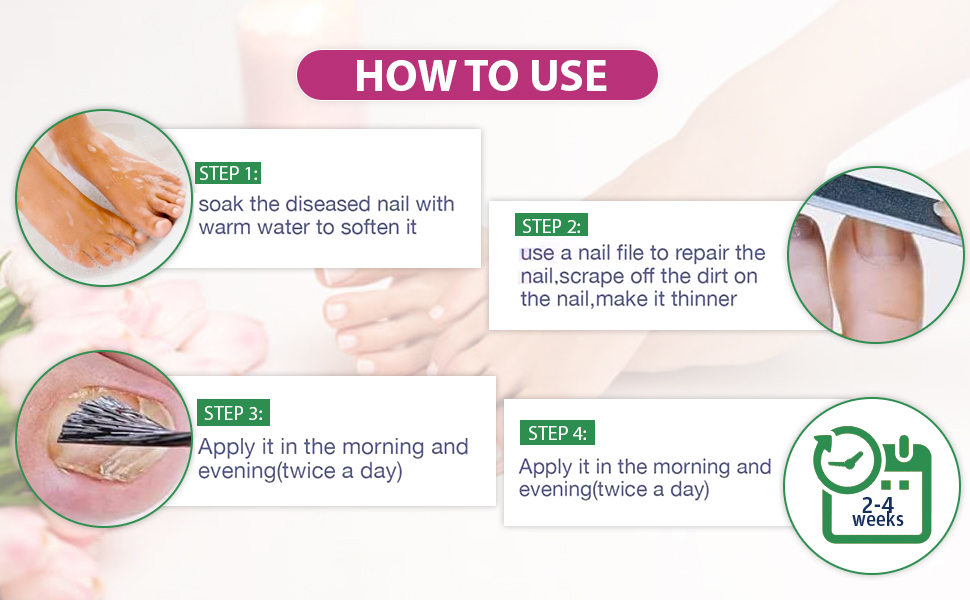 Toenail Fungus Treatment 1