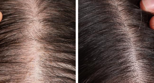 hair serum for hair growth