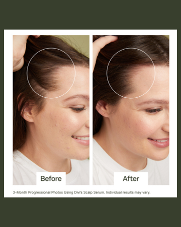 Scalp Serum Before & After