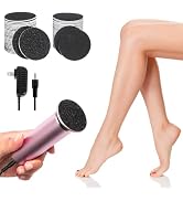 Ranrose Electric Foot Callus Remover for Women - Professional Pedicure Tool for Smooth Skin Remov...
