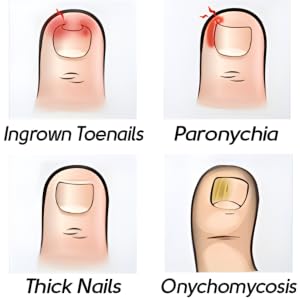 nail clippers