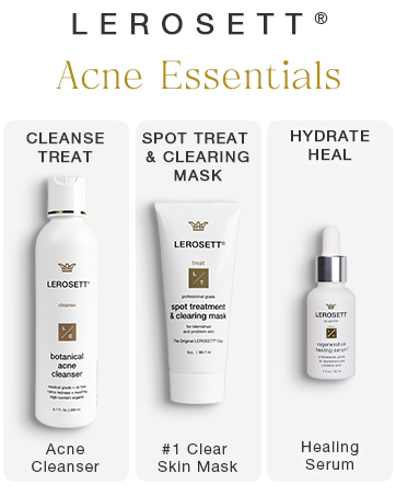 Acne Essentials