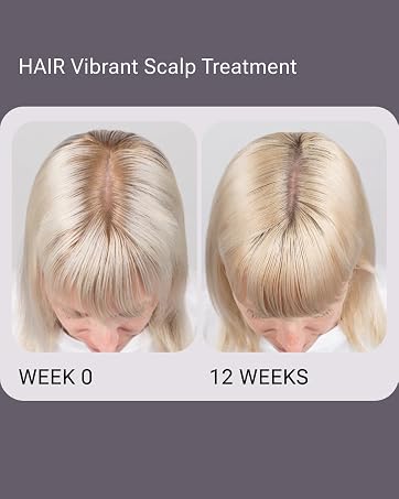 Hair Vibrant scalp Treatment results