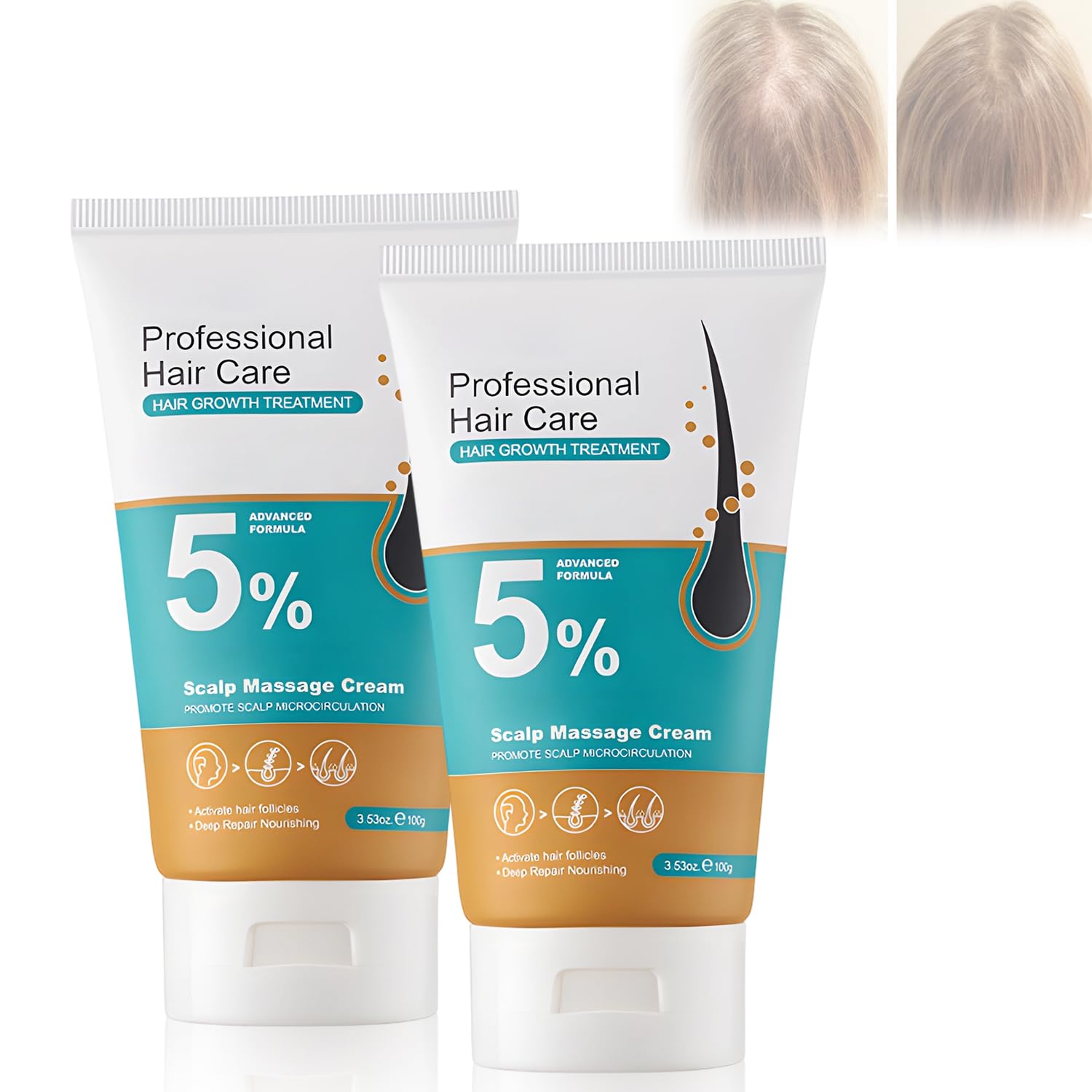 Hair Fall Control Cream ? Prevents Hair Loss