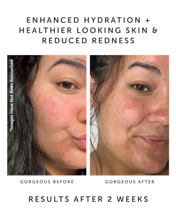 ENHANCED HYDRATION + HEALTHIER LOOKING SKIN & REDUCED REDNESS RESULTS AFTER 2 WEEKS