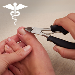 precision point for clipping ingrown toenail