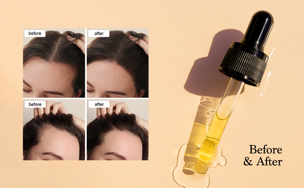 OIL 1PCS